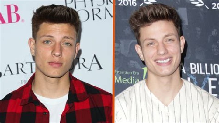 Alx James Bio, Wiki, Age, Height, Boyfriend Breakup, Vine, Net Worth, Waterbugs and Plastic Surgery